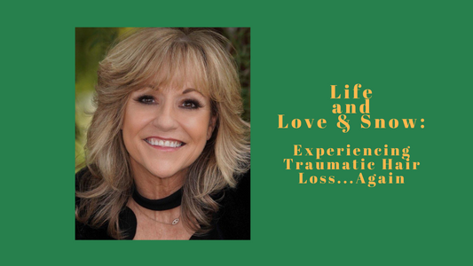 Life and Love & Snow - Bryn's Story: Experiencing Traumatic Hair Loss...Again